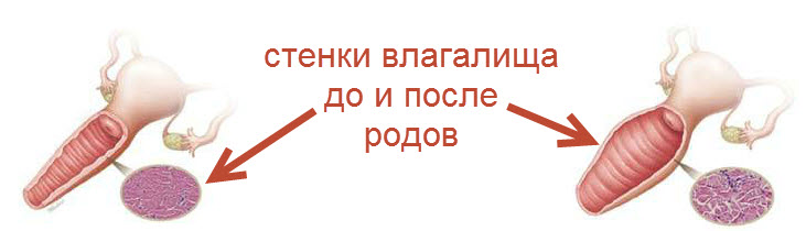 Влагалище до и после родов